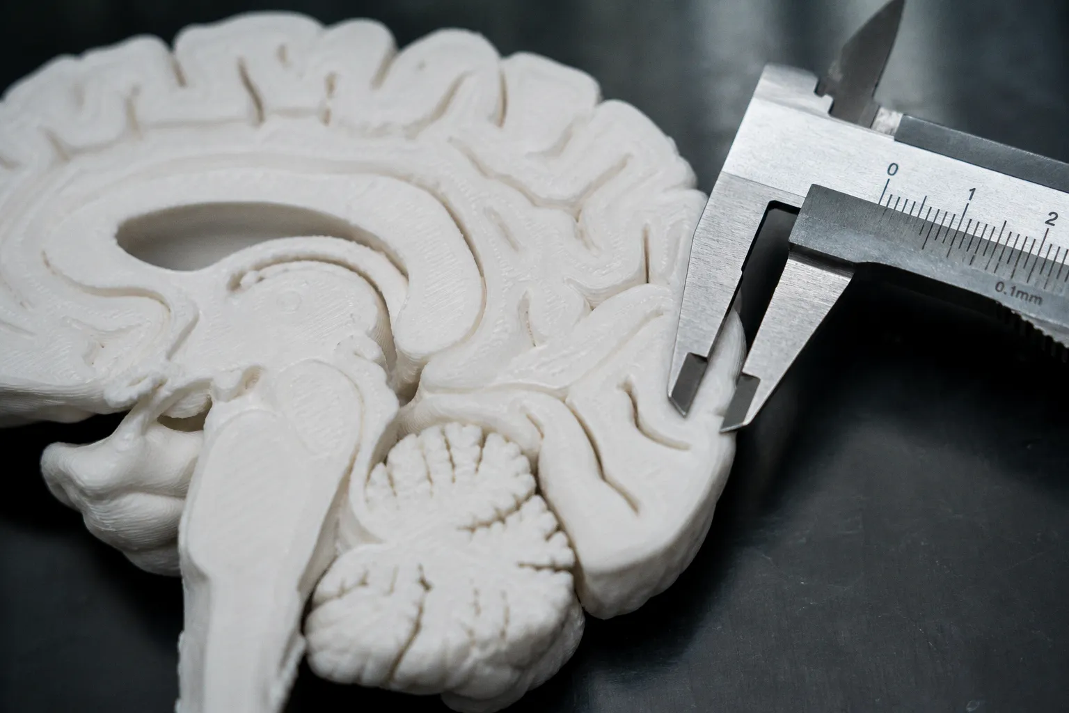 Cortical thickness pipeline errors and how to fix them